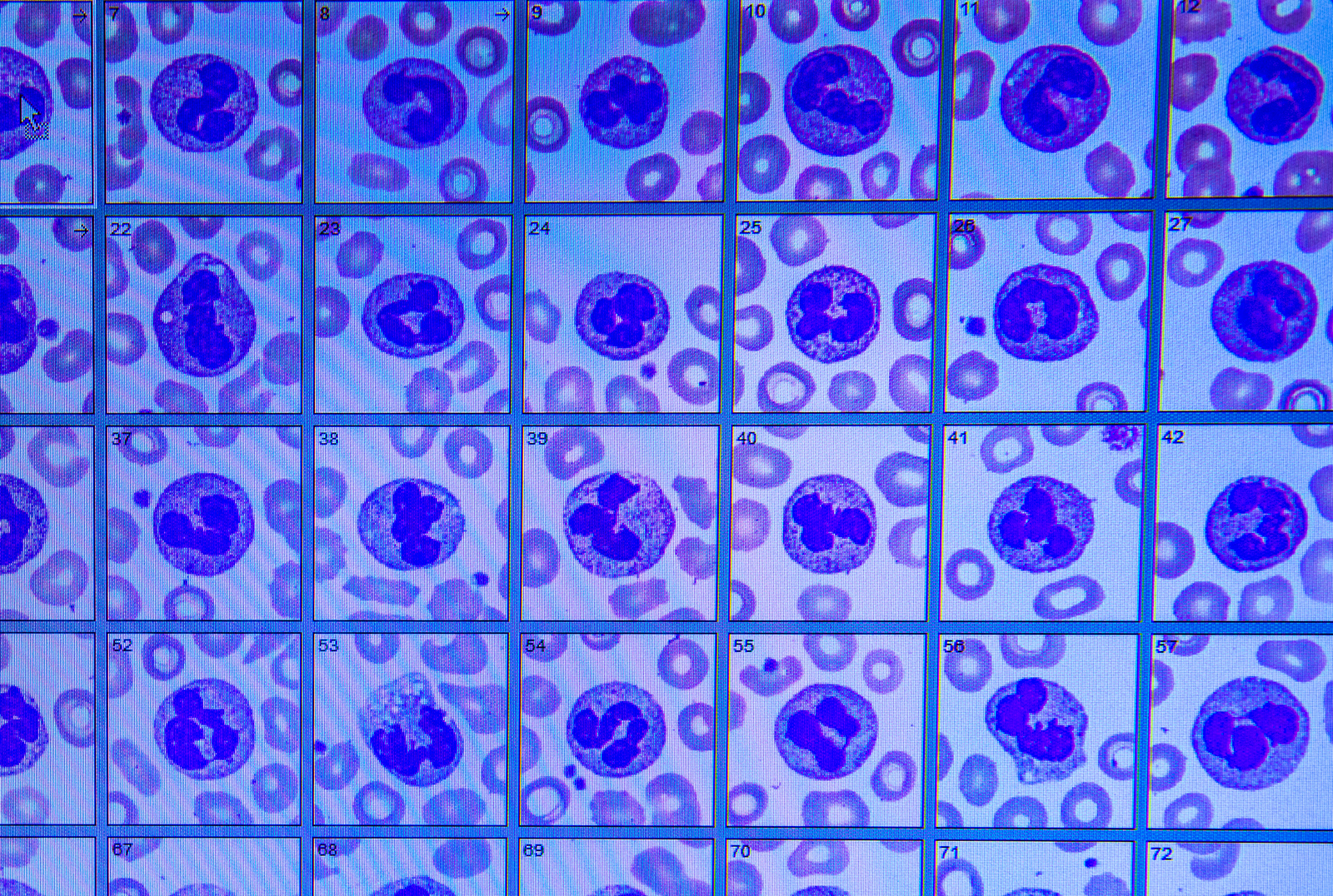 Image of Hematology laboratory
